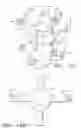 Fig. 10 - Orthosis