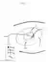 Fig. 02 - DEVICE FOR TRACTION WOUND CLOSURE