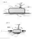 Fig. 04 - DEVICE FOR TRACTION WOUND CLOSURE