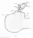 Fig. 02 - USE OF PUMP TO DELIVER A SOLUTION TO REDUCE SNORING