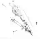 Fig. 02 - WIRE AND DEVICE FOR VASCULAR TREATMENT