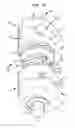 Fig. 09 - External fixation component
