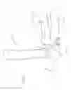 Fig. 07 - Internal joint stabilizer device, system and method of use