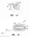 Fig. 04 - Ear insert for relief of TMJ discomfort and headaches