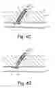 Fig. 06 - Methods for sealing a vascular puncture using a plug including unreactive precursors