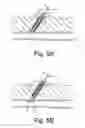 Fig. 08 - Methods for sealing a vascular puncture using a plug including unreactive precursors