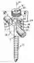 Fig. 01 - Threadform for medical implant closure
