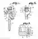 Fig. 02 - Threadform for medical implant closure