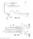 Fig. 09 - Responsive gastric stimulator