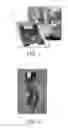 Fig. 02 - Method and system for dynamic recalibration of tens stimulation points to compensate for changing electrode conditions with fail-safe and auto-recovery functionality