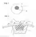 Fig. 02 - CARRIER AND KIT FOR INTRALUMINAL DELIVERY OF ACTIVE PRINCIPLES OR AGENTS