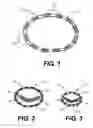 Fig. 02 - Implantable devices for controlling the size and shape of an anatomical structure or lumen