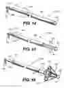 Fig. 06 - Implantable devices for controlling the size and shape of an anatomical structure or lumen