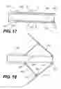 Fig. 07 - Implantable devices for controlling the size and shape of an anatomical structure or lumen