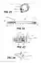 Fig. 09 - Implantable devices for controlling the size and shape of an anatomical structure or lumen