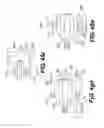 Fig. 33 - Implantable devices for controlling the size and shape of an anatomical structure or lumen
