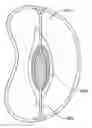 Fig. 01 - Methods, systems and devices for cardiac valve repair