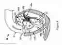 Fig. 08 - Methods, systems and devices for cardiac valve repair
