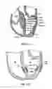Fig. 33 - Methods, systems and devices for cardiac valve repair