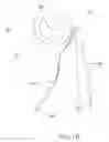 Fig. 07 - ANNULOPLASTY SYSTEM AND SURGICAL METHOD
