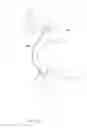 Fig. 09 - ANNULOPLASTY SYSTEM AND SURGICAL METHOD