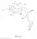 Fig. 45 - ANNULOPLASTY SYSTEM AND SURGICAL METHOD