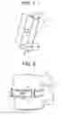 Fig. 02 - Minimally invasive intervertebral staple distraction devices