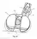 Fig. 45 - Position adjustable trial systems for prosthetic implants