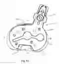 Fig. 43 - Position adjustable trial systems for prosthetic implants