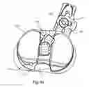 Fig. 45 - Position adjustable trial systems for prosthetic implants