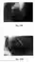 Fig. 76 - ANTI-ANGIOGENIC COMPOSITIONS AND METHODS OF USE
