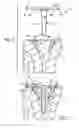 Fig. 03 - Prosthetic implant support structure