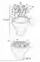 Fig. 06 - Prosthetic implant support structure