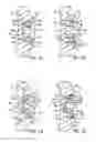 Fig. 10 - Prosthetic implant support structure