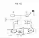 Fig. 103 - Method for controlling flow in a bodily organ