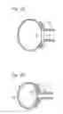 Fig. 109 - Method for controlling flow in a bodily organ