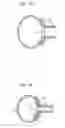 Fig. 117 - Method for controlling flow in a bodily organ