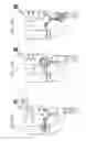 Fig. 127 - Method for controlling flow in a bodily organ