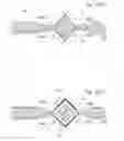 Fig. 151 - Method for controlling flow in a bodily organ