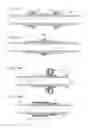 Fig. 174 - Method for controlling flow in a bodily organ