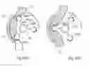 Fig. 33 - Method for controlling flow in a bodily organ