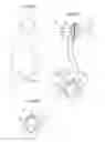 Fig. 48 - Method for controlling flow in a bodily organ