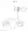 Fig. 49 - Method for controlling flow in a bodily organ
