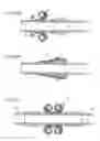 Fig. 81 - Method for controlling flow in a bodily organ