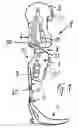 Fig. 02 - Connecting element for orthopedic components