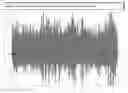 Fig. 01 - Method for detecting and filtering a random noise signal
