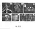 Fig. 03 - Development of very early flowering and normal fruiting plum with fertile seeds