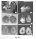 Fig. 05 - Development of very early flowering and normal fruiting plum with fertile seeds