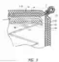 Fig. 06 - BED BUG PROOF MATTRESS