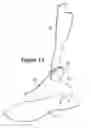 Fig. 13 - Protective boot
